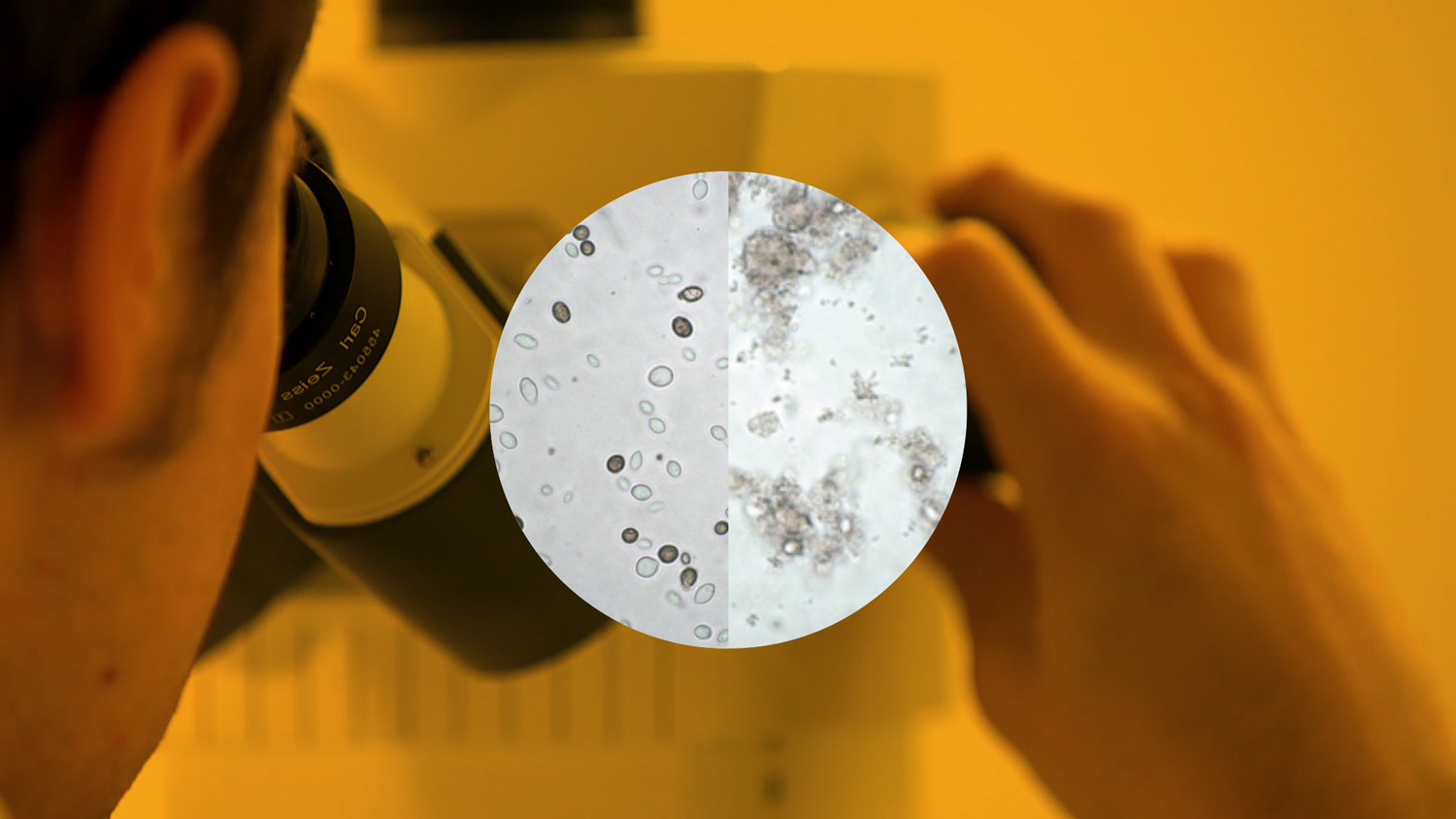 Chitocel efficacy against Brettanomyces explained by means of laboratory tests Chitocel action against Brettanomyces